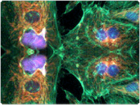 showcase.par.50167.image.0.0.1 Arcturus® LCM Process Overview