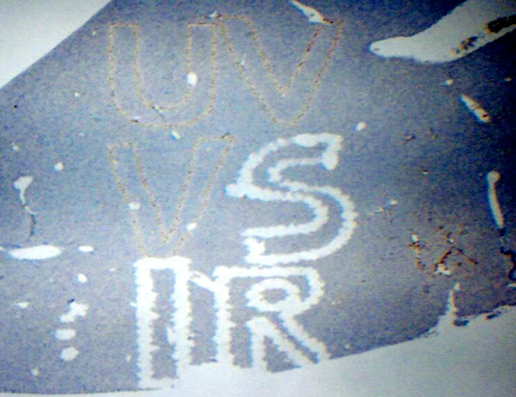 dat-lcm-vs-lmd Laser Capture Microdissection System Overview