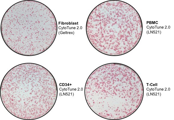 iPS colonies in 4 different cell culture dishes made visible via alkaline phosphatase staining iPS colonies in 4 different cell culture dishes made visible via alkaline phosphatase staining