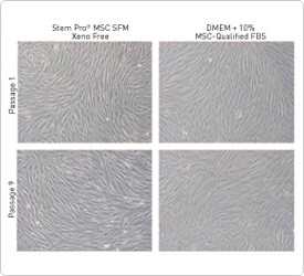 Human BM-MSC morphology StemPro MSC SFM XenoFree medium