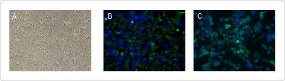 hNSCs grown on CELLstart-coated dishes hNSCs grown on CELLstart-coated dishes in serum-free medium exhibit normal morphology and express hNSC markers