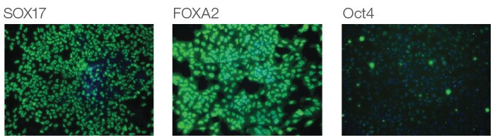 Immunofluorescence imaging results Three panel immunofluorescence imaging results showing expression of SOX17, FOXA2, and Oct4 in induced hESCs.