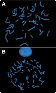 labeling-oligos-nucleic-acids.par.73862.image.180.298.1.s001737-fluorescence-in-situ-hybridization-gif labeling-oligos-nucleic-acids.par.73862.image.180.298.1.s001737-fluorescence-in-situ-hybridization-gif