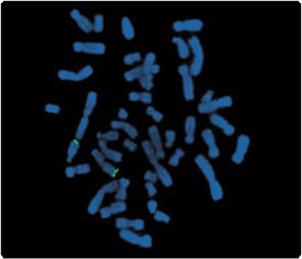 labeling-oligos-nucleic-acids.par.92443.image.275.236.1.s001314-fluorescence-in-situ-hybridization-gif labeling-oligos-nucleic-acids.par.92443.image.275.236.1.s001314-fluorescence-in-situ-hybridization-gif