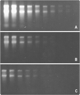 nucleic-acid-detection-electrophoretic-gels.par.13544.image.275.323.1.s000164-rna-detection-gif nucleic-acid-detection-electrophoretic-gels.par.13544.image.275.323.1.s000164-rna-detection-gif