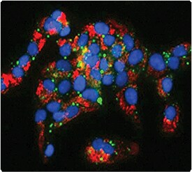 fatty-acid-analogs-phospholipids.par.22877.image.275.247.1.s006640-multiplex-detection-gif fatty-acid-analogs-phospholipids.par.22877.image.275.247.1.s006640-multiplex-detection-gif