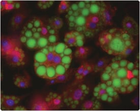 fatty-acid-analogs-phospholipids.par.10271.image.275.219.1.s003264-lipidtox-green-gif fatty-acid-analogs-phospholipids.par.10271.image.275.219.1.s003264-lipidtox-green-gif