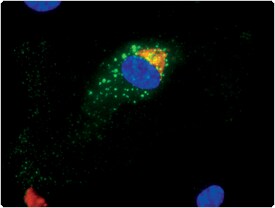 probes-lysosomes.par.52464.image.275.208.1.s006951-lysosomes-gif probes-lysosomes.par.52464.image.275.208.1.s006951-lysosomes-gif