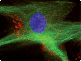 probes-lysosomes.par.76553.image.275.208.1.s006950-lysosomes-gif probes-lysosomes.par.76553.image.275.208.1.s006950-lysosomes-gif