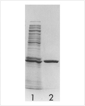 multiplexed-proteomics-technology.par.45565.image.275.343.1.s000185-sds-polyacrylamide-gel-gif multiplexed-proteomics-technology.par.45565.image.275.343.1.s000185-sds-polyacrylamide-gel-gif