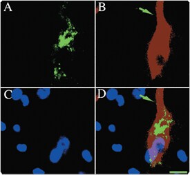 qdot-nanocrystals.par.96635.image.275.254.1.s003294-qdot-streptavidin-conjugates-gif qdot-nanocrystals.par.96635.image.275.254.1.s003294-qdot-streptavidin-conjugates-gif