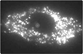 qdot-nanocrystals.par.1536.image.275.180.1.s002764-qdot-nanocrystals-cytoplasmic-gif qdot-nanocrystals.par.1536.image.275.180.1.s002764-qdot-nanocrystals-cytoplasmic-gif