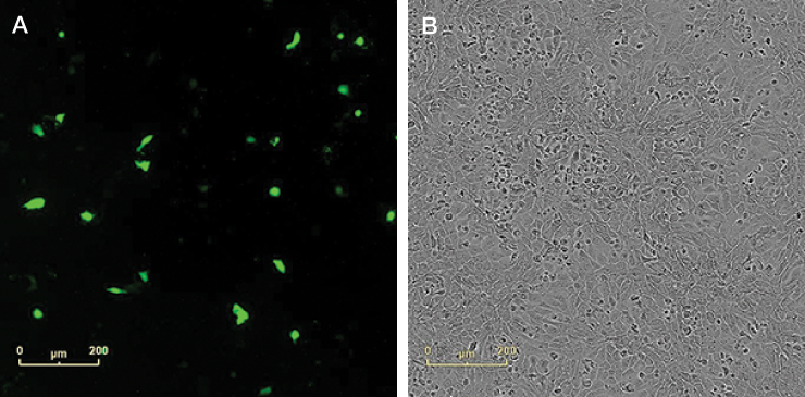 Post-transfection analysis of cells Post-transfection analysis of cells
