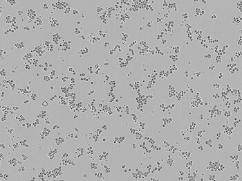 Brightfield image of MDA-MB-453 cells in culture, prior to transfection. Brightfield image of MDA-MB-453 cells in culture, prior to transfection.